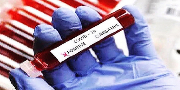  2 New Positive Coronavirus Case Identified Today
