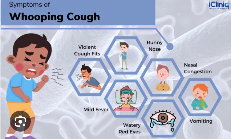  Whooping cough case Identified here in Bermuda say Health Ministry